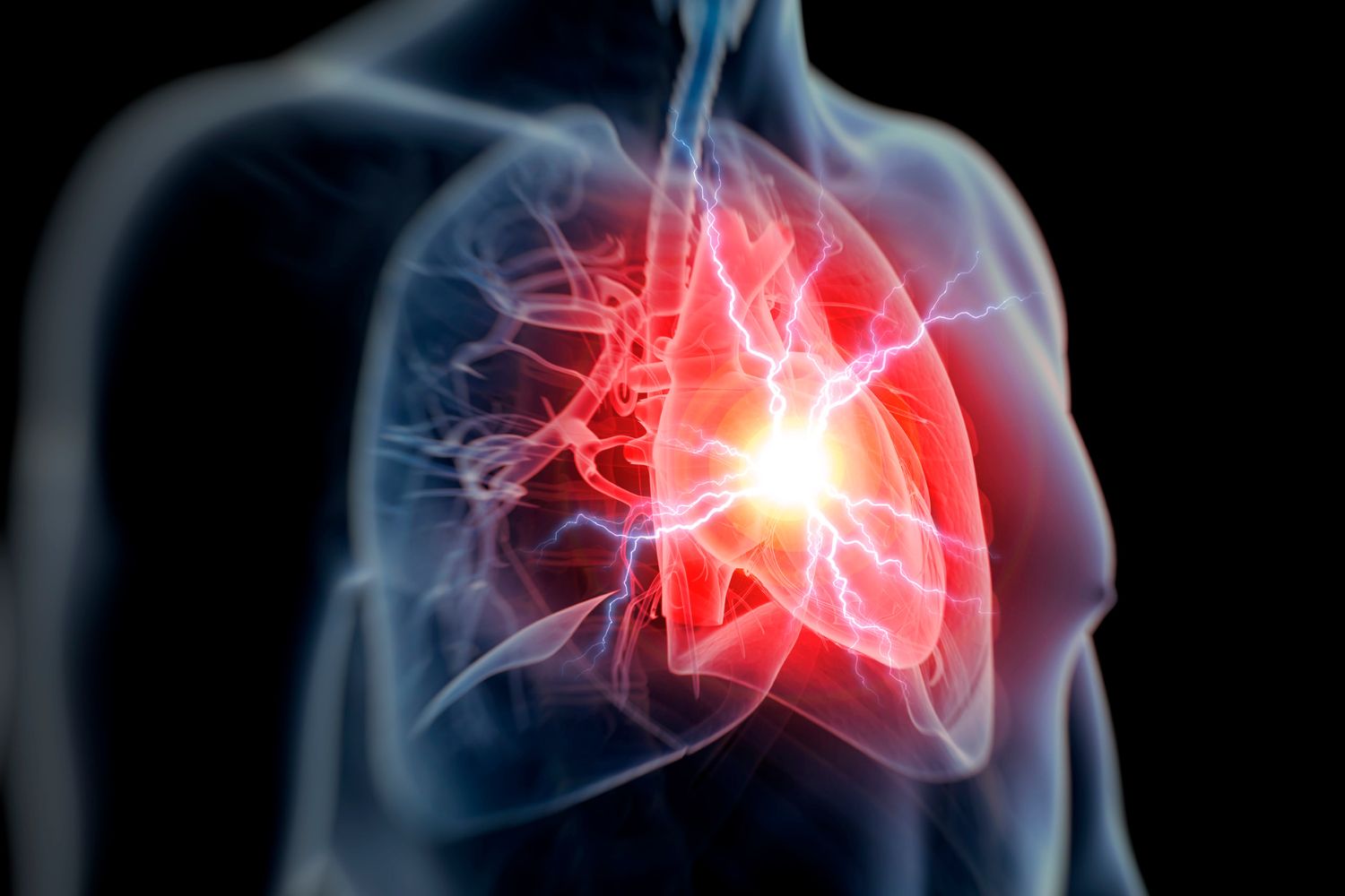 Cardiovascular clinical trials